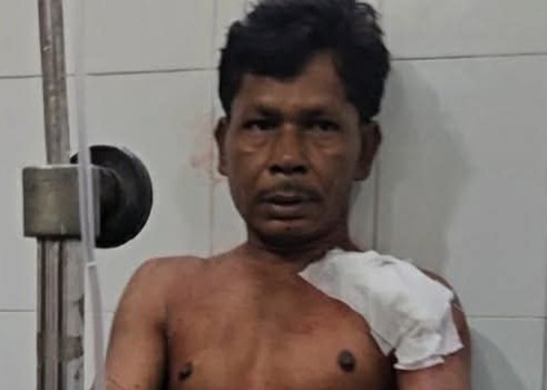 পঞ্চগড়ে প্রতিপক্ষের ছুরিকাঘাতে আহত হোটেল শ্রমিক