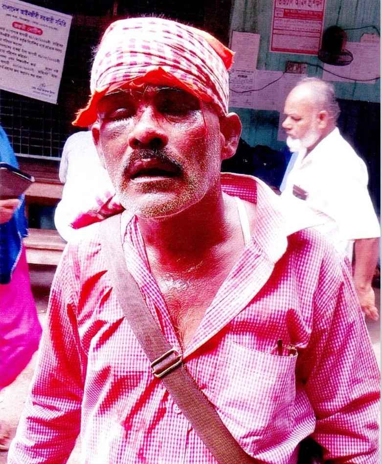 দিনাজপুরে ৪র্থ স্বামীর উপর হামলা। স্ত্রী কারাগারে