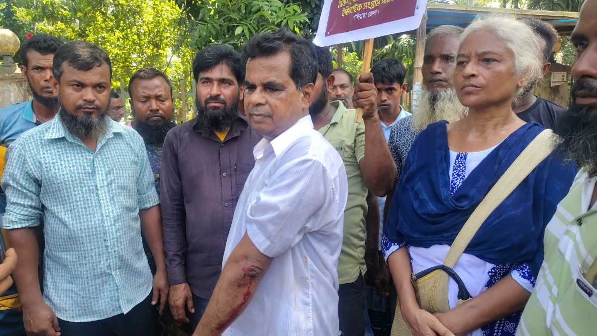 গাইবান্ধায় ইজিবাইক চালকদের কর্মসূচিতে হামলা, আহ্বায়কসহ আহত কয়েকজন 