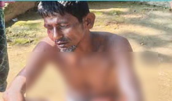 লোকালয়ে শিয়ালের হানা, স্বামী-স্ত্রীসহ আহত ৫
