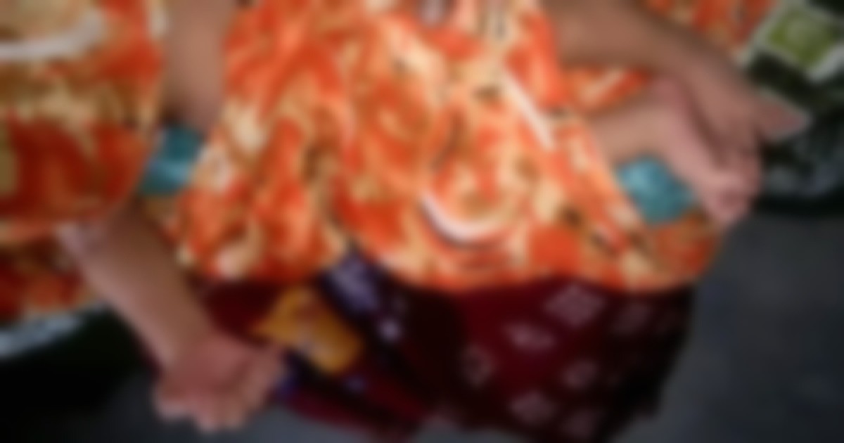 ফুলবাড়ীতে ২৮ আঙুল নিয়ে শিশুর জন্ম